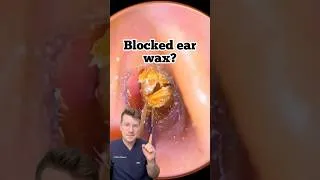 Thumbnail: Blocked ear wax? Try these three drops… #shorts