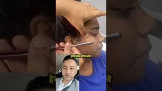 Thumbnail: Should you shave your face hair? How to do it properly? #facecaretips #skincare e