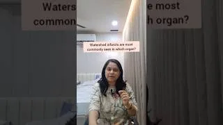 Thumbnail: Watershed Infarct #brain #viral #fypシ