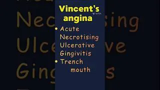 Thumbnail: Vincent's angina: 2 minutes clinical review / Membrane over tonsil