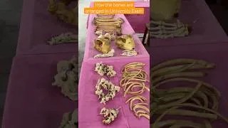 Thumbnail: Arrangement of Bones In Anatomy Viva