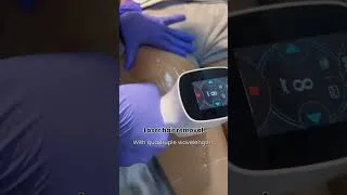 Thumbnail: #laserhair#lhr #lasertreatment #laserclinics #followus