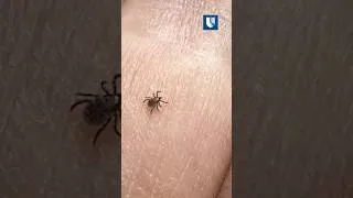 Thumbnail: Found a Tick? Watch for These Warning Signs