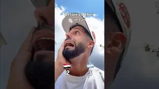 Thumbnail: Argentina VS Egypt 🇪🇬 🇦🇷
