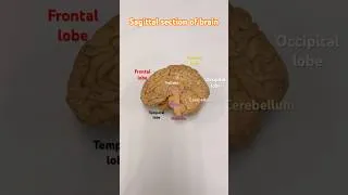 Thumbnail: Brain @Easy_Anatomy #medical #anatomy #biology #nursing #indianmedicalstudent #srilankaneducation