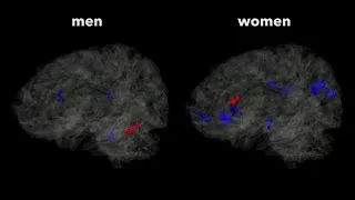 Thumbnail: Women More Vulnerable to Brain Injury from Soccer Heading