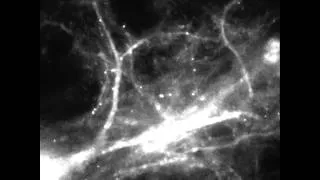 Thumbnail: The Molecular Basis of Memory: Tracking mRNA in Brain Cells in Real Time