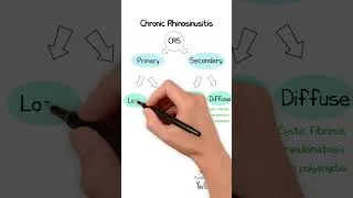 Thumbnail: Chronic Rhinosinusitis MCQ 1 ANSWER #ent #chronicrhinosinusitis #FRCS