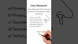 Thumbnail: Chronic Rhinosinusitis MCQ 1  #ent #chronicrhinosinusitis  #FRCS