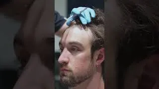 Thumbnail: This Performer's Hair Loss Started As A Teenager 😳