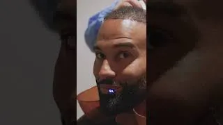 Thumbnail: The Real Reason Men Go Bald (Daniel's Story) 👀