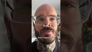 Thumbnail: 9-Month Beard Transplant Result | Natural Growth Journey