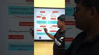 Thumbnail: 4th episode of ecg || ECG || Nursing #exammark