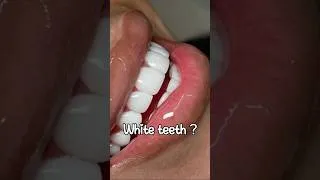 Thumbnail: White teeth tips 🌸#glowup #beautyhacks #teenglowup