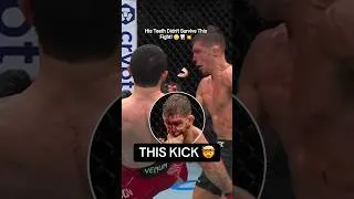 Thumbnail: His Teeth Didn't Survive This Fight! 😳🦷💥