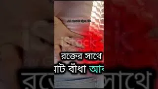 Thumbnail: মাসিকের কিছু বিপদজনক চিহ্ন #periodfeatures