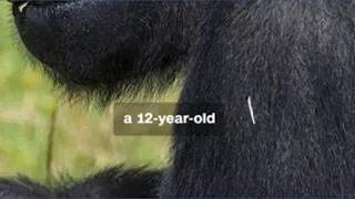Thumbnail: Gorilla undergoes historic surgery