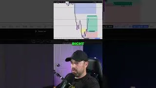Thumbnail: Stop Trading Now! Secure Your 87 Points Profit