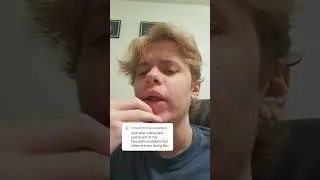 Thumbnail: Face reveal at 100k