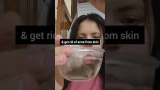 Thumbnail: bye ACNE & dark CIRCLES 🎀✨ #skincare #shorts #viralskincare #acnetreatment #skincarehack