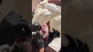 Thumbnail: Liquid Microneedling for Glass Skin | Cellstory Treatment (Esthetician)