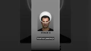 Thumbnail: Hair Loss Ki Har Stage Ka Best Treatment | Stage 1 to Stage 7