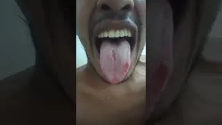 Thumbnail: Big Mouth #trending