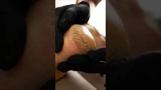 Thumbnail: How I Fix The Deepest Cracked Heels