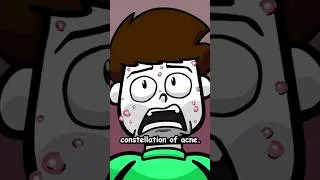 Thumbnail: My Acne was HORRIBLE…