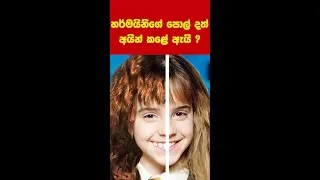 Thumbnail: හර්මයිනිගේ පොල් දත් දෙක 😱