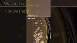 Thumbnail: Sundew and bacteria Timelapse🧫😨