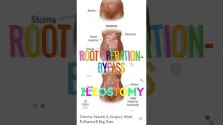 Thumbnail: Root operation-Bypass