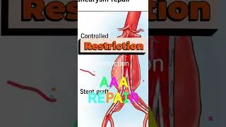 Thumbnail: Root operation-Restriction #hcc #education