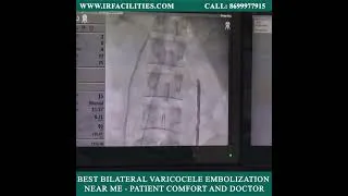 Thumbnail: Best Bilateral Varicocele Embolization near me - Patient Comfort and Doctor