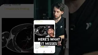 Thumbnail: Should you get a full body MRI?