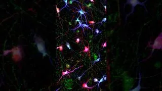 Thumbnail: New stem cell toolkit could unlock some of the biggest questions in Parkinson's disease research