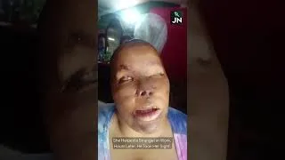 Thumbnail: Jamaican Woman Helped a Stranger at Work. Hours Later, He Took Her Sight.