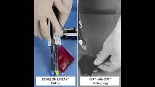 Thumbnail: ECHELON LINEAR Cutter Gel Demo vs GIA Stapler with DST | J&J MedTech