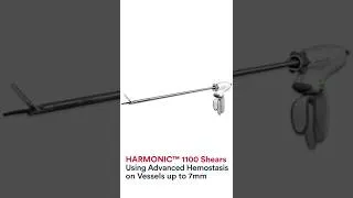Thumbnail: HARMONIC 1100 Shears Technique Video: Using Advanced Hemostasis for Vessel Sealing | J&J MedTech