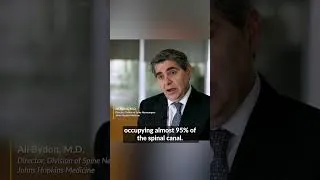Thumbnail: Spine Schwannoma Tumor | Sarah’s Story