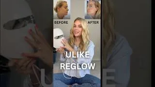 Thumbnail: 1 YEAR RESULTS | ULIKE REGLOW MASK | DOES THIS THINGS REALLY WORK?!