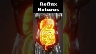 Thumbnail: Why Your Reflux Keeps Coming Back