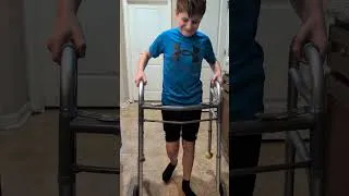 Thumbnail: Jakob is WALKING!!! Two weeks after major surgery to repair a broken femur my baby boy is WALKING!!!