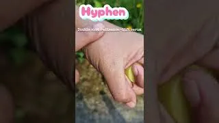 Thumbnail: #glowserum ✨#Hyphen #DoubleShotSerum #Skincare #GlowSkin #SkincareRoutine #