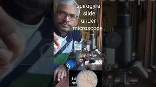 Thumbnail: Spirogyra slide under microscope #biology #practical #spotting #