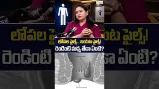 Thumbnail: Internal Piles vs External Piles: ఏది ఎక్కువ ప్రమాదం? | #PilesTreatment, #PilesSymptoms