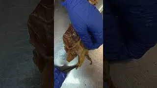 Thumbnail: Interior of Caecum & Appendix (Part 2) | Cadaveric Anatomy | MBBS, NEET PG & INI-CET