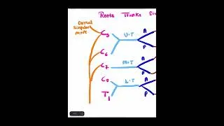 Thumbnail: Master Brachial Plexus Fast! | Medical Students Must Know