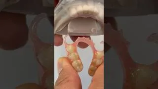 Thumbnail: FiberFlex partial from digital model for Dr. Ashley Lee in Indiana