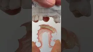 Thumbnail: FiberFlex partial for Mollie Rojas in Illinois